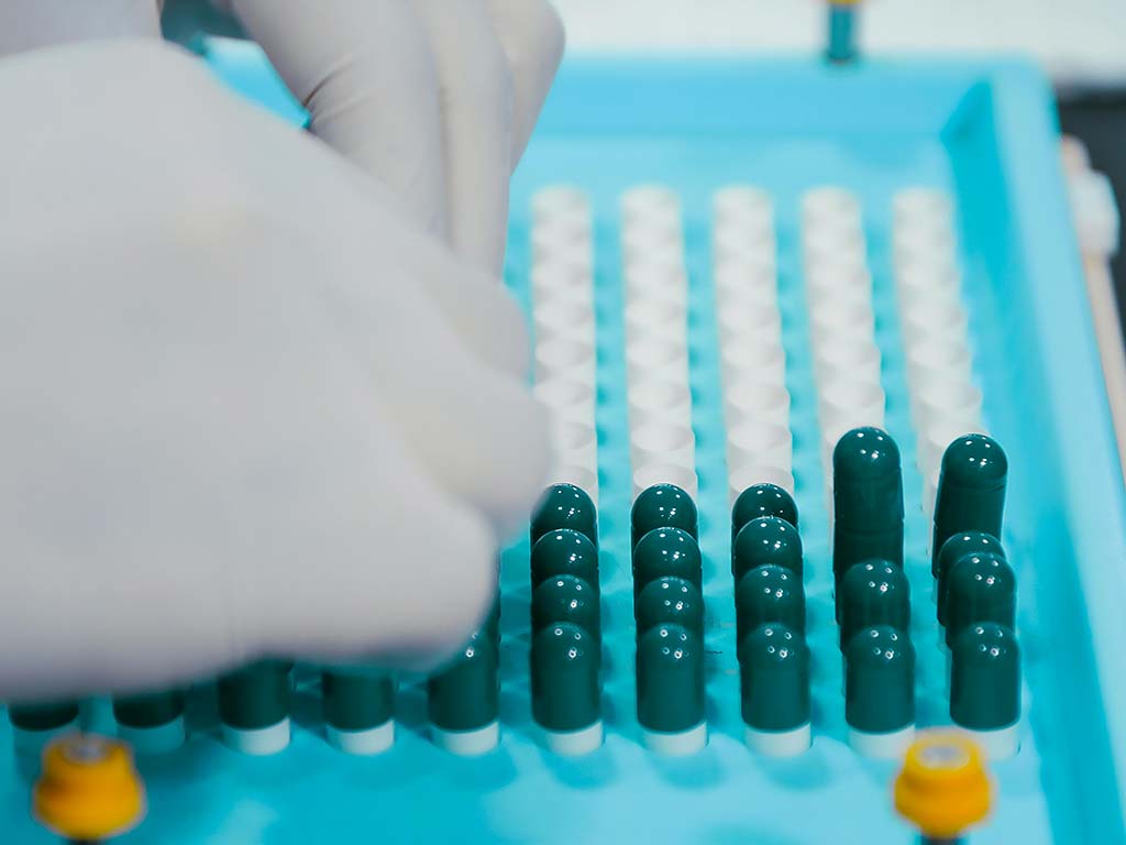 Manuelle Befüllung von Kapseln in einem Labor – steht für Qualitätsmanagement und sichere Prozesse in der pharmazeutischen Produktion.